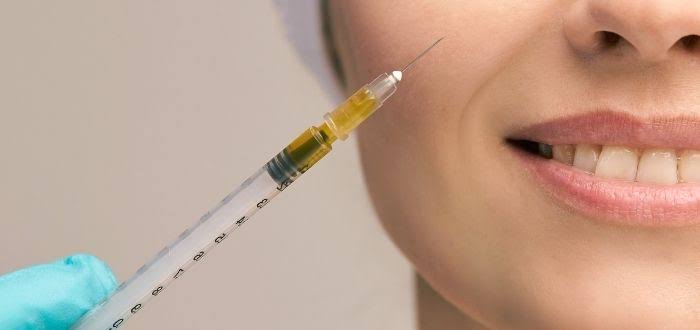 Micro-needling application delivering PRP into the dermis
