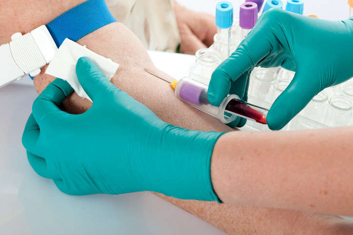 Sterile blood draw before PRP treatment