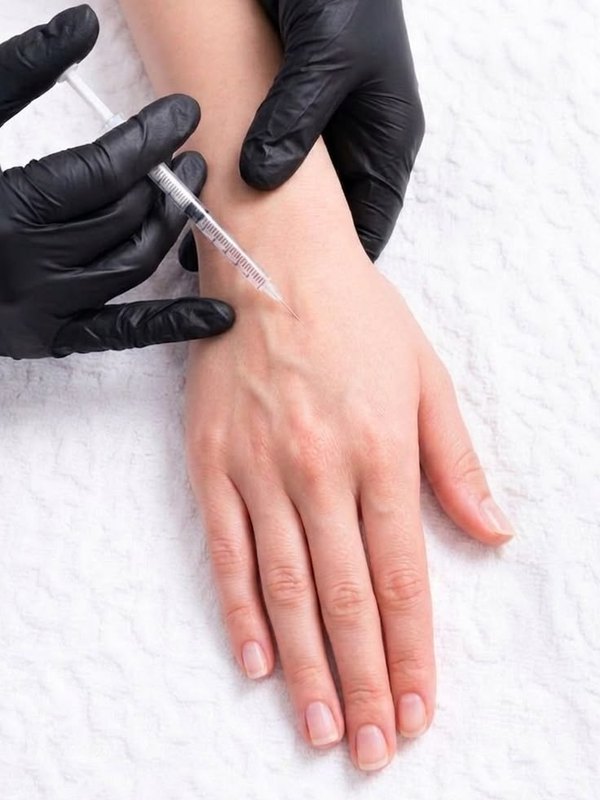 Hand Rejuvenation Filler